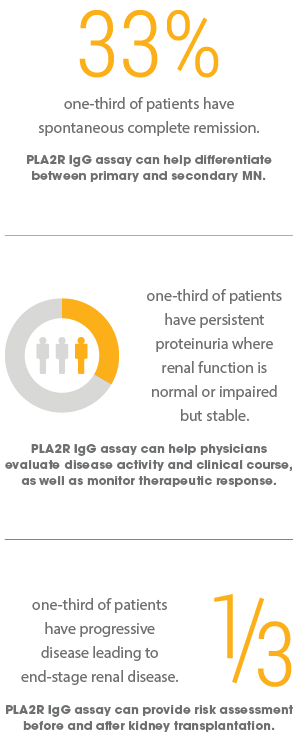 Benefits of the PLA2R IgG Assay