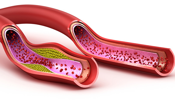 Blood Vessels