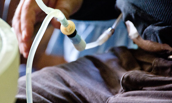 A man receiving peritoneal dialysis, illustrates chronic kidney disease