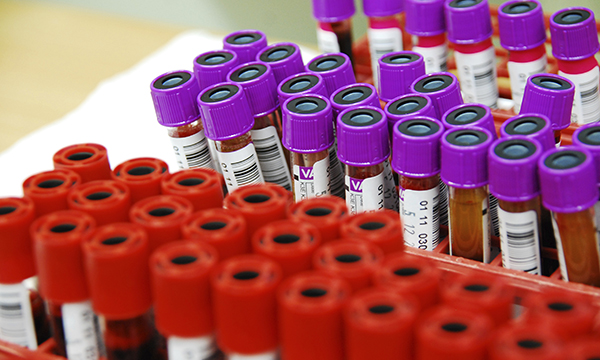  Blood test specimen tubes