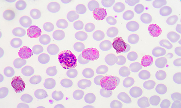 Blood Smear Microscopic Image