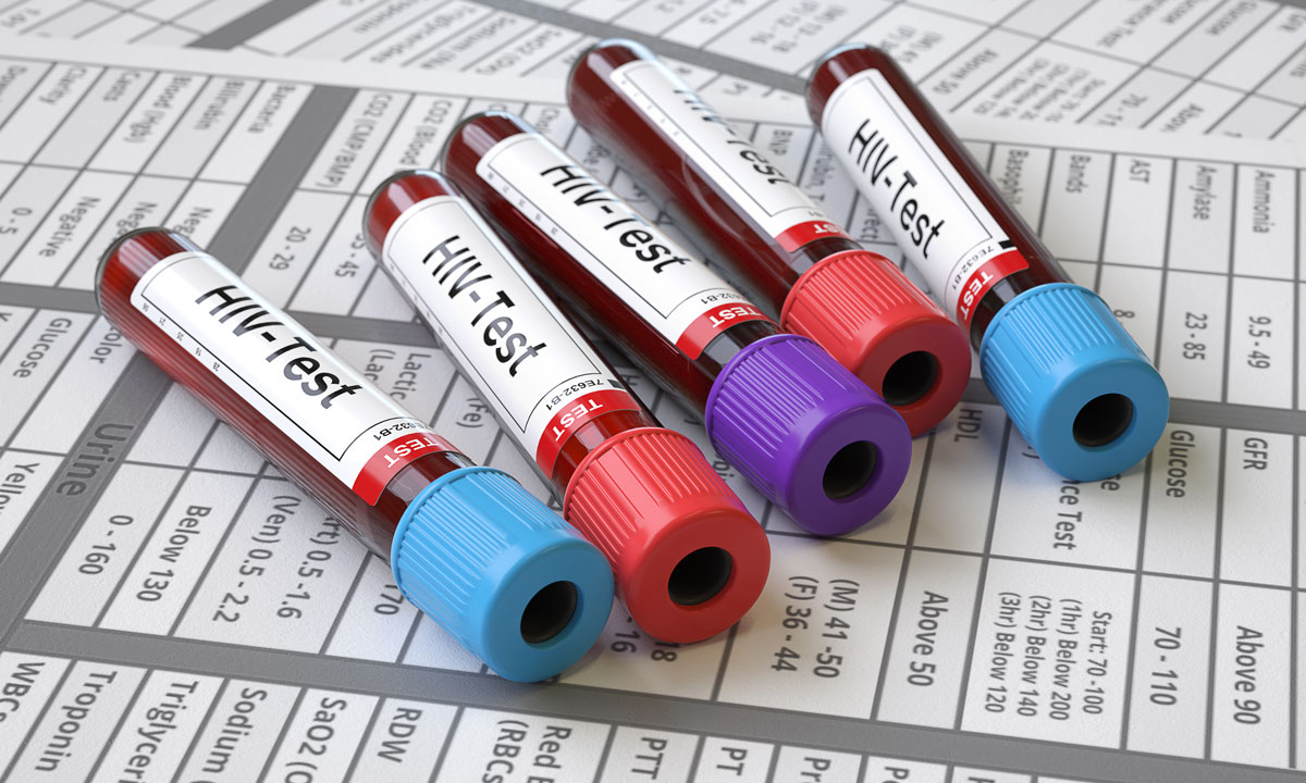 Five HIV test specimen tubes are placed on a sheet that lists reference intervals.