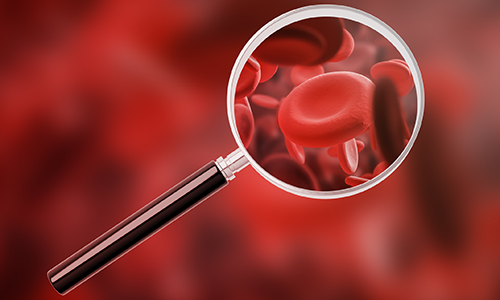 photo illustration of a magnifying glass showing a red blood cell