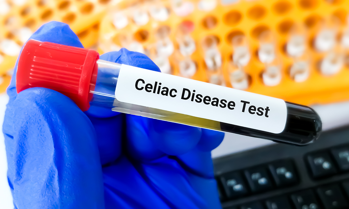 Test sample for celiac disease