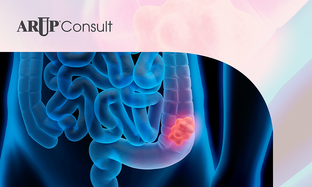Photo illustration of an X-ray view of intestines and colon with red cancer growth