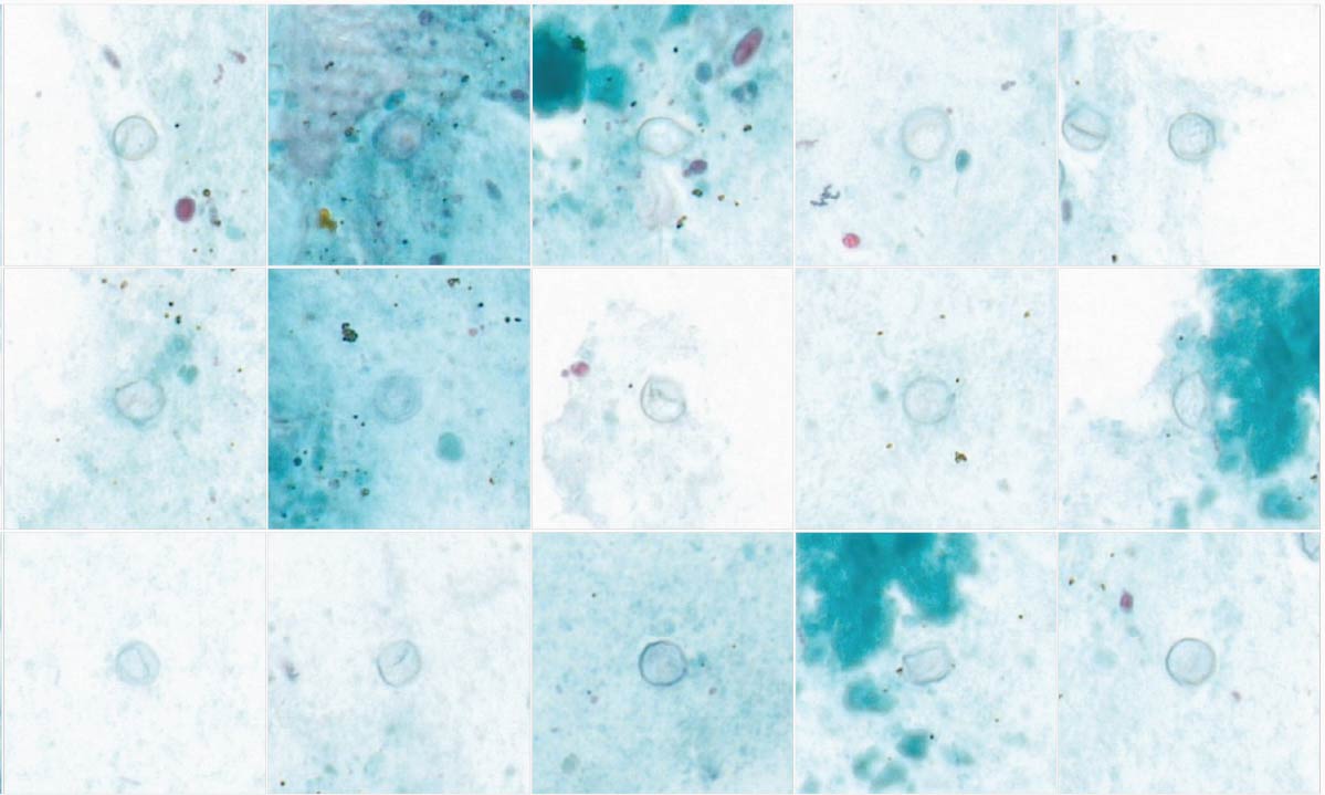 Microscopic images of Cyclospora
