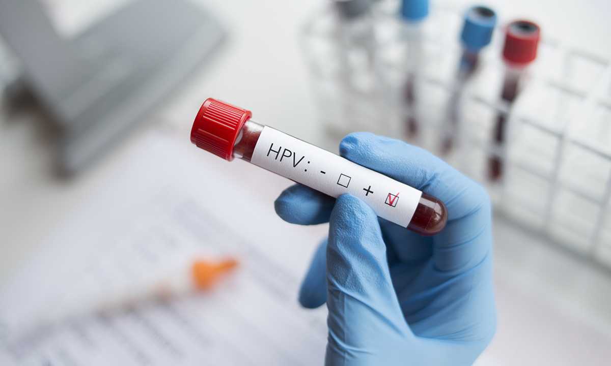 HPV test sample