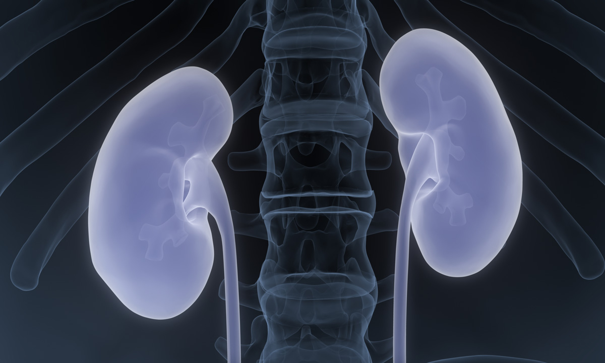 X-ray image of kidneys