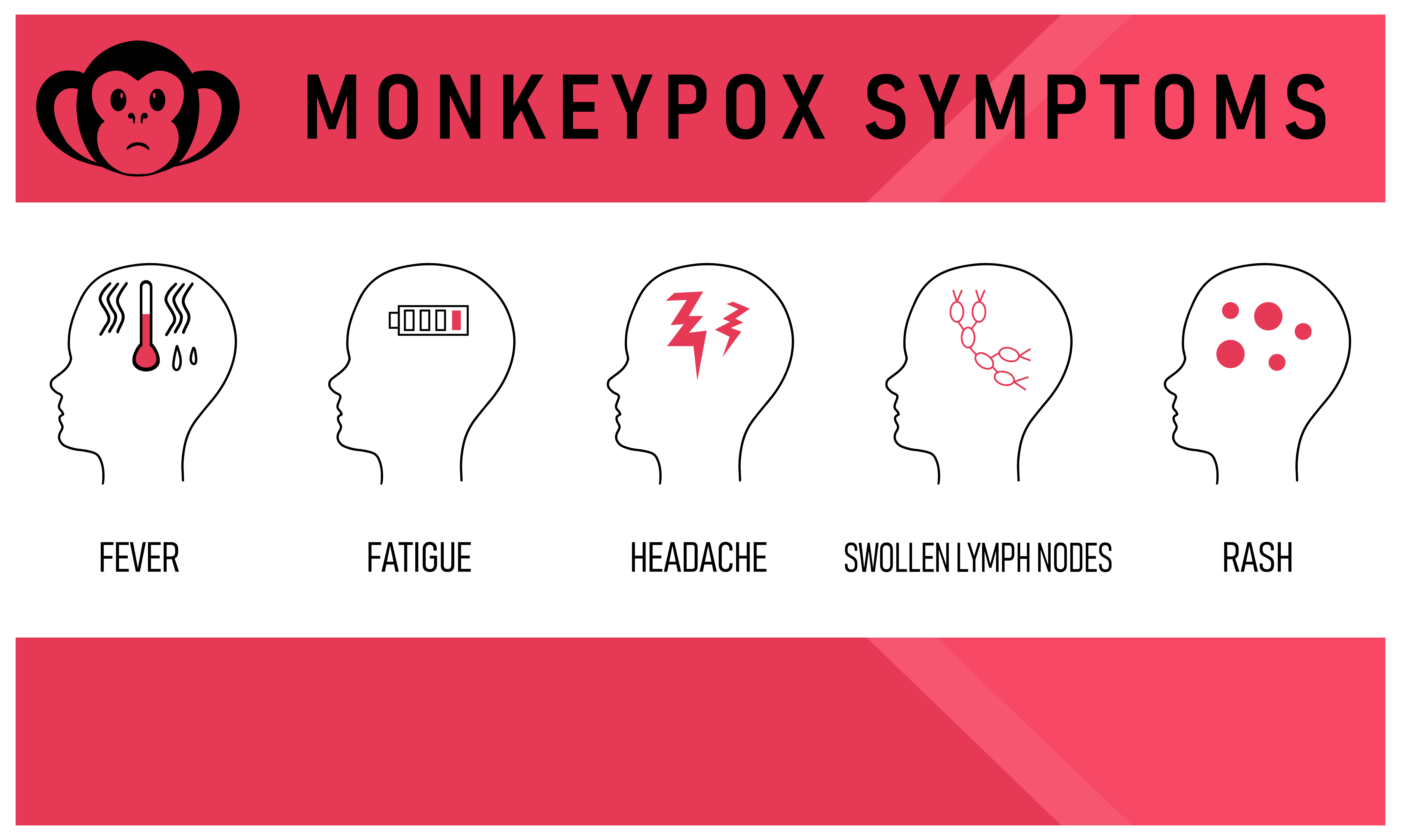 Monkey Pox Infographic