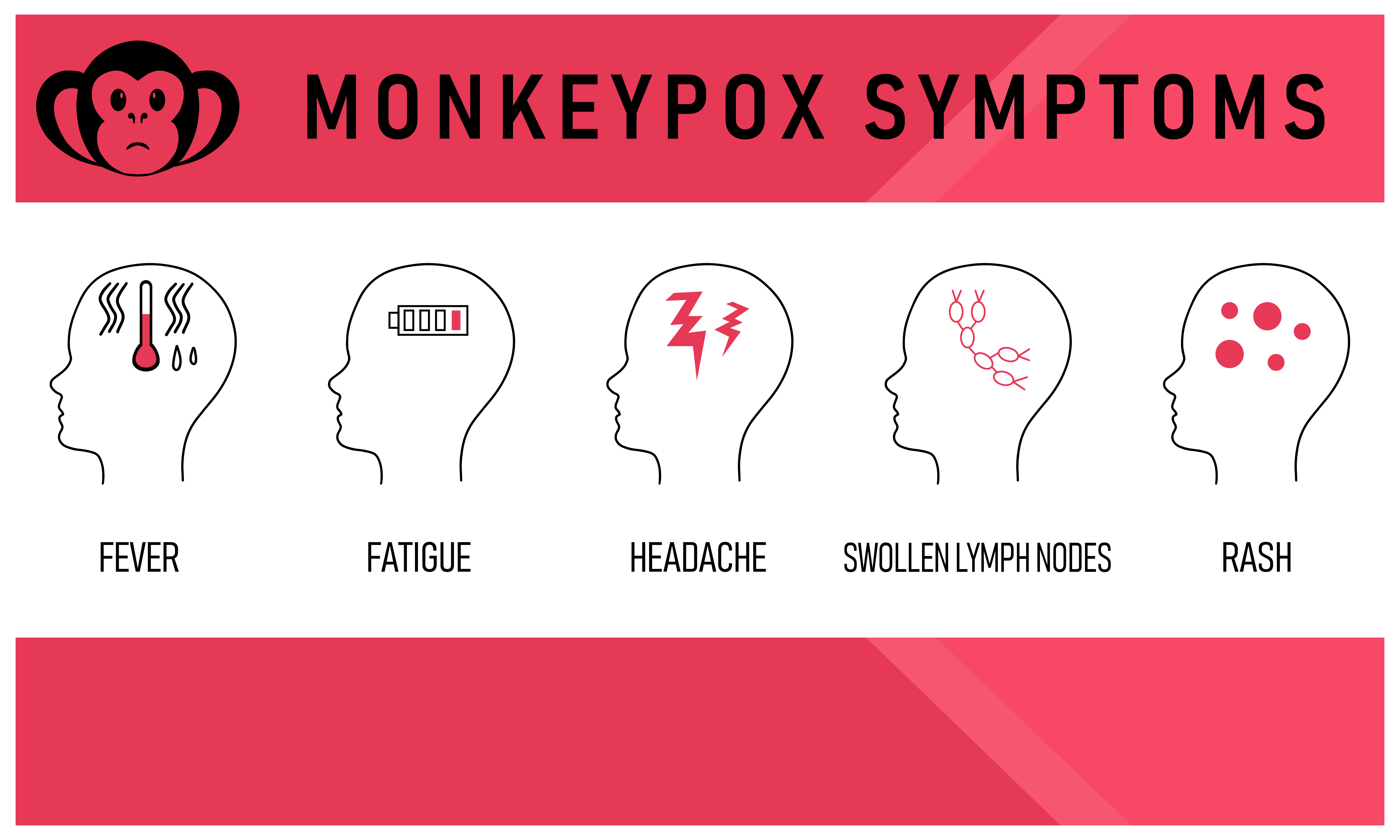 Monkeypox Presentations, Prevention Strategies Shifting