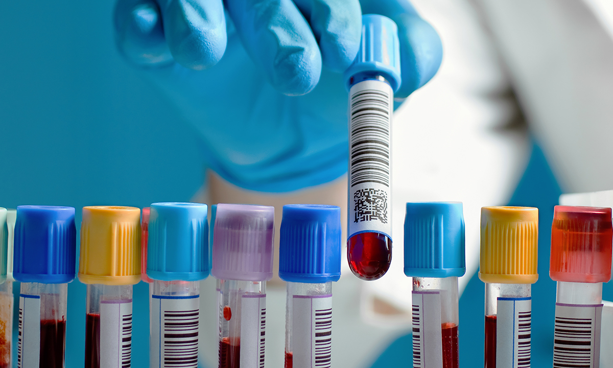 A clinician removes a sample from a tray of samples.