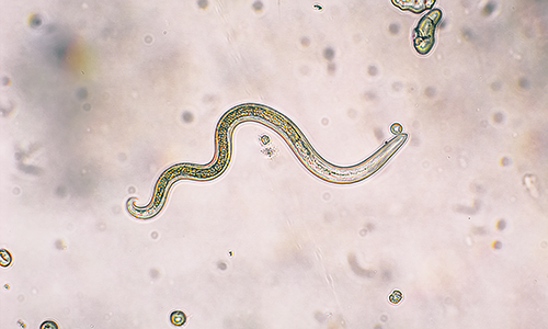 A microscopic slide of a parasitic roundworm
