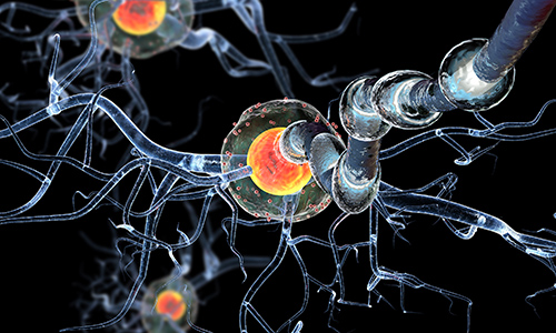 llustration of autoimmune neurologic diseases neural pathway