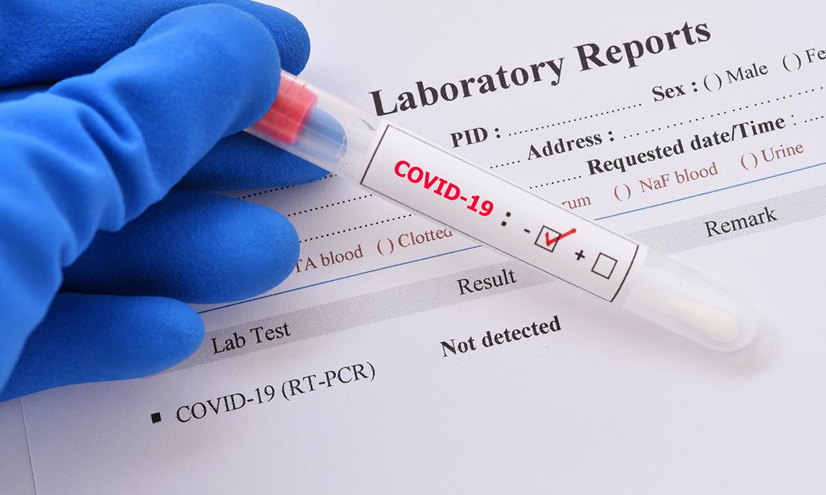 Gloved hand holds a COVID-19 test sample