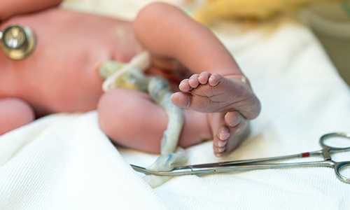 Photo of newborn with umbilical cord
