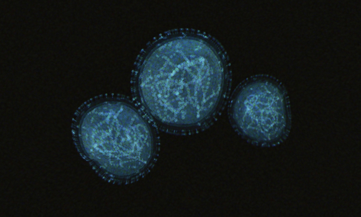 Monkeypox molecules