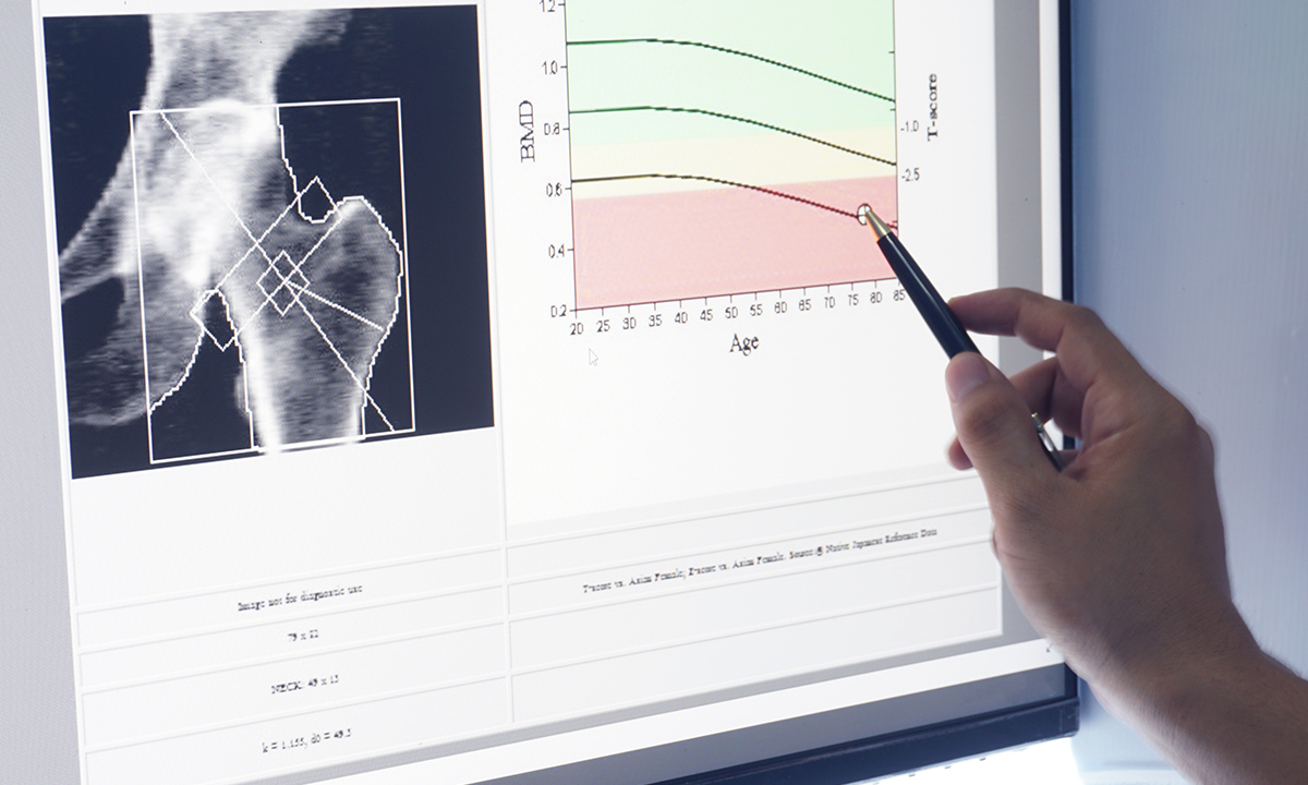 A clinician examines a computer screen with an X-ray of bones.