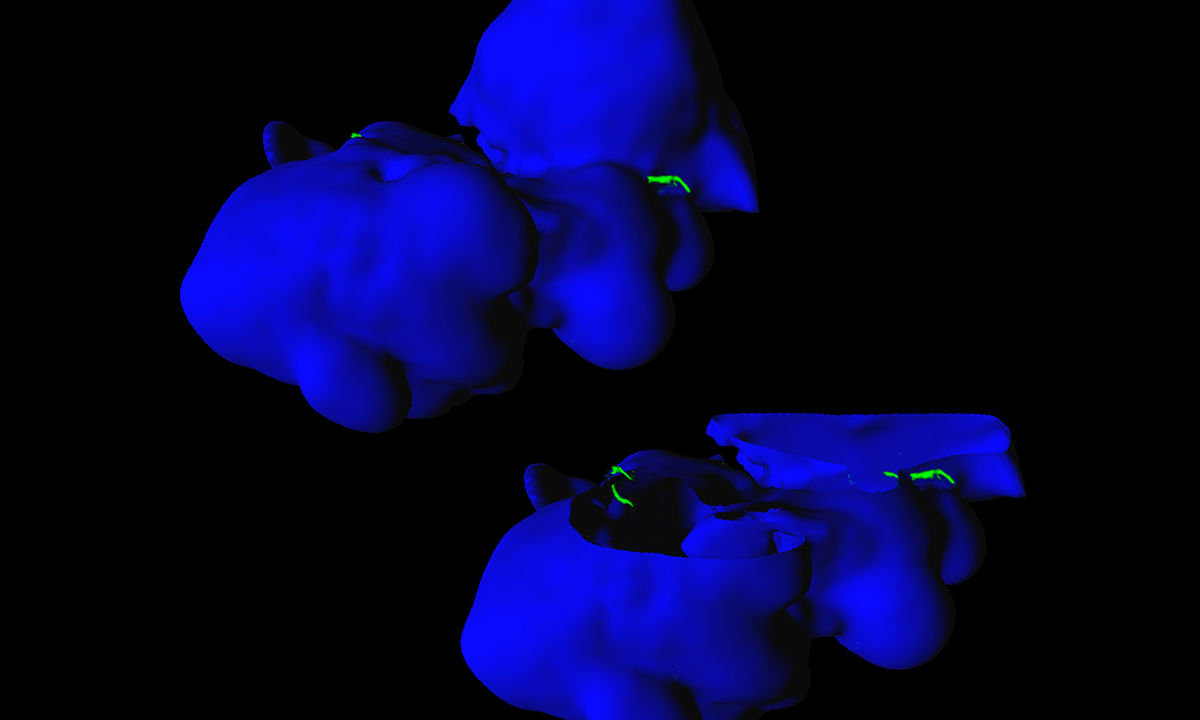 Ixodes scapularis deer tick salivary glands displayed in blue with invading Borrelia burgdorferi spirochetes Lyme disease-causing bacteria shown in green