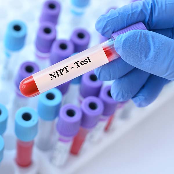 nipt test sample