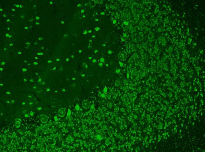 Microscopic immunofluorescent pattern