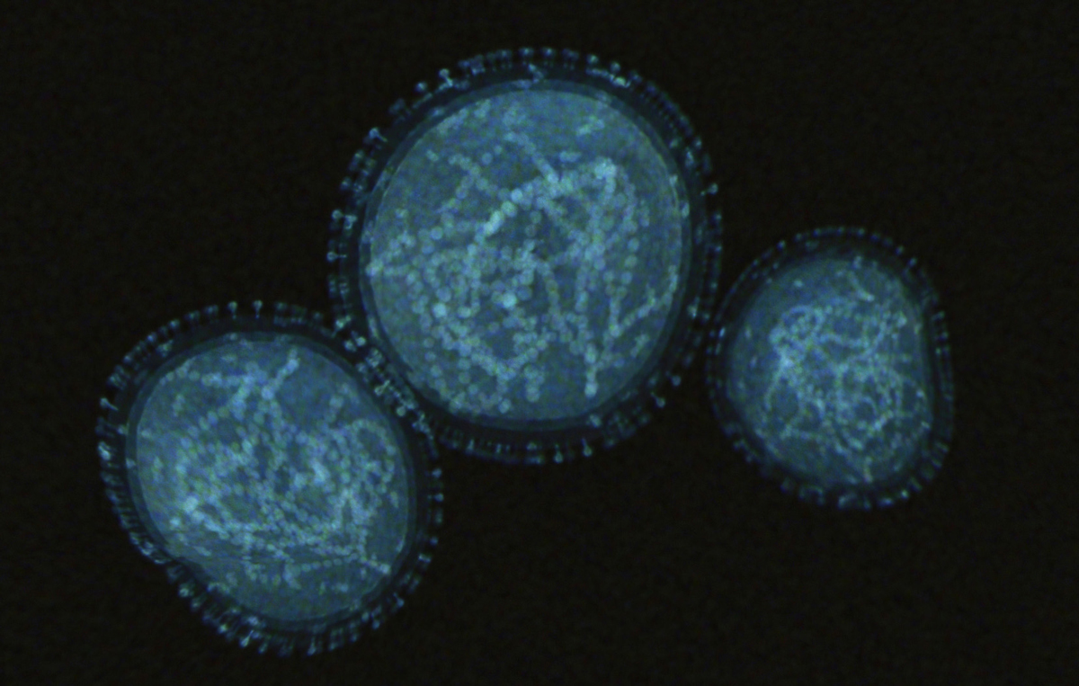 Visualization of the monkeypox virus