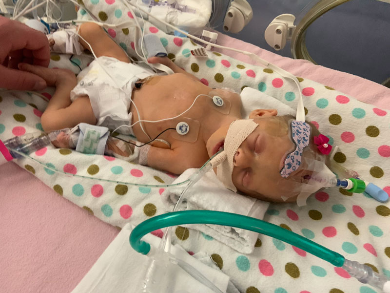 Baby Nevaeh shown in the NICU with an adult hand touching her tiny foot