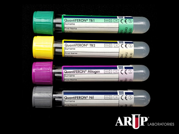 Order Of Blood Draw Chart 2014