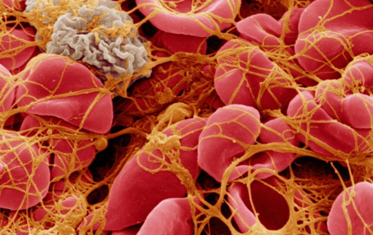 ARUP Hemostasis