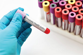 Test tube with prostate health index text.
