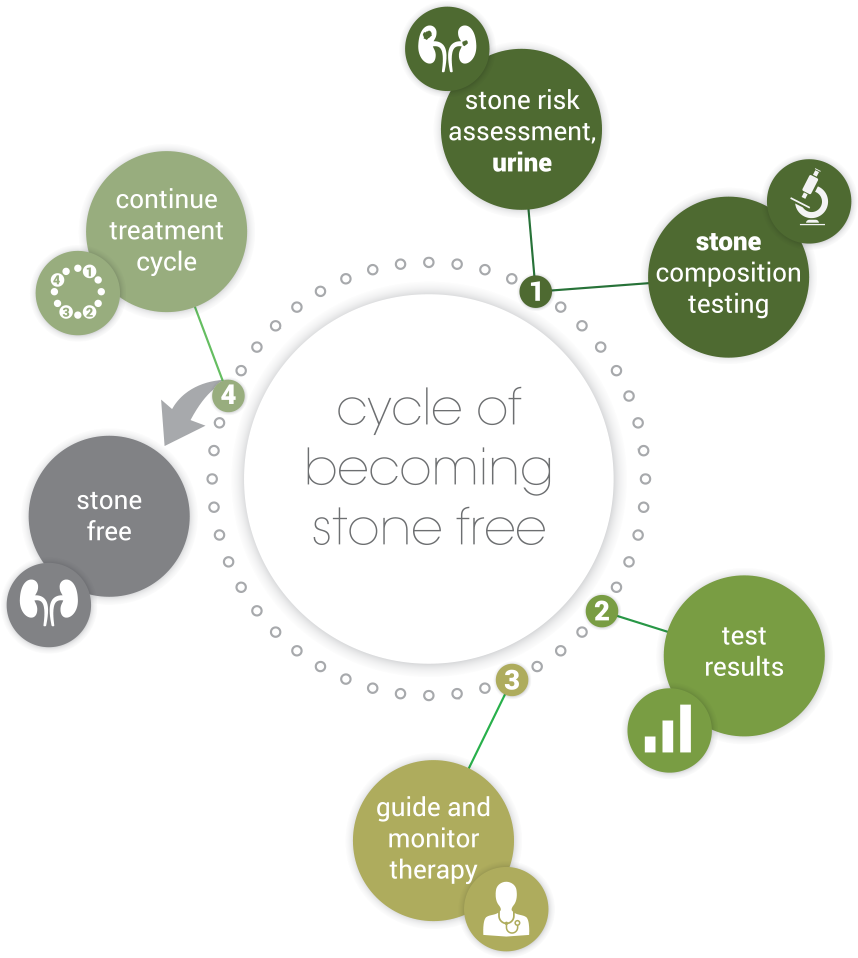 Kidney stone formation and calculi testing graphic