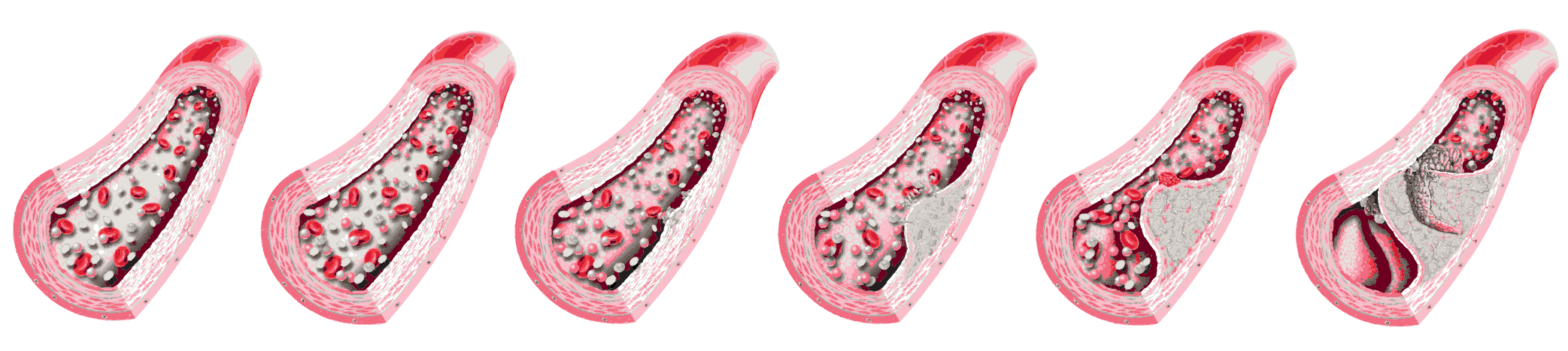 Illustration of a lipid particle