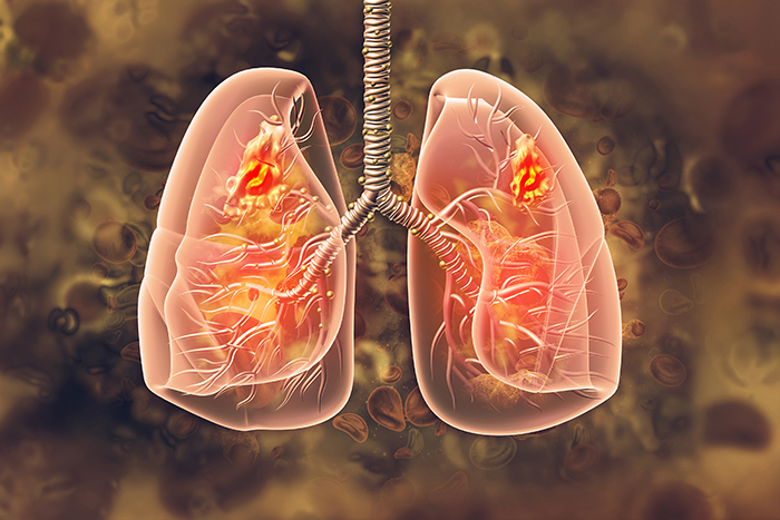 Illustration of Lungs