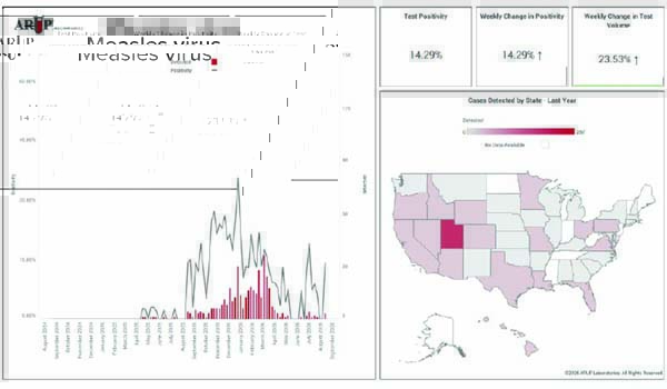 Measles dashboard screenshot